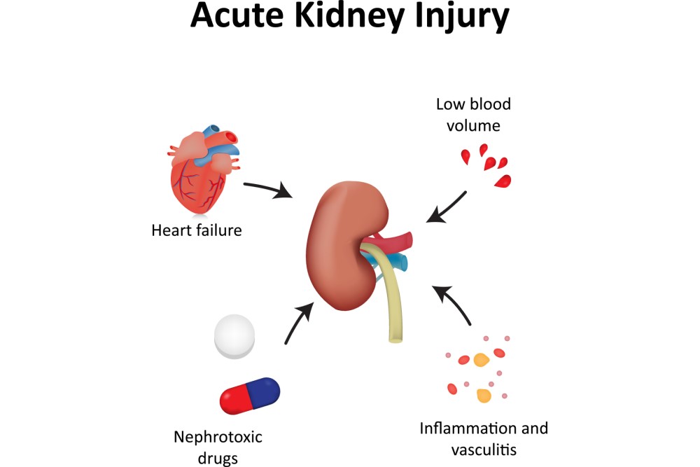 Can Kidney Failure Happen Suddenly