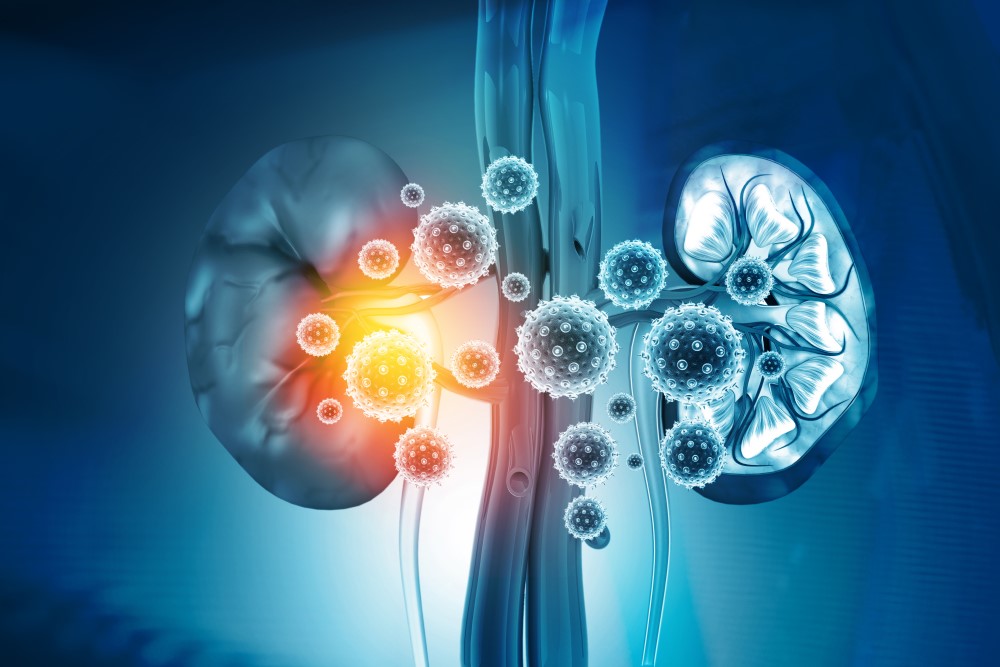 Chronic Kidney Disease