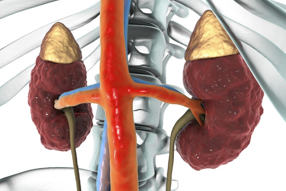 Renal Cystic Diseases